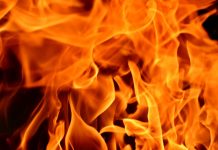 Personal Injury: Scarring, Burns and Disfigurement personal injury Scarring and burns