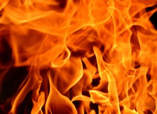personal injury Scarring and burns