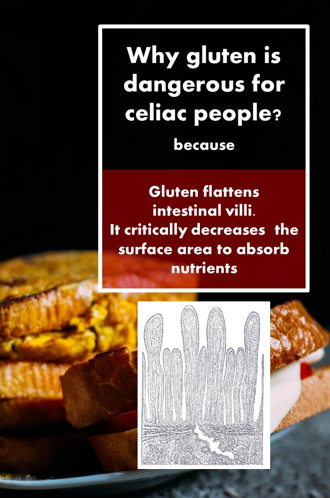 Gluten in foods where you least expect it