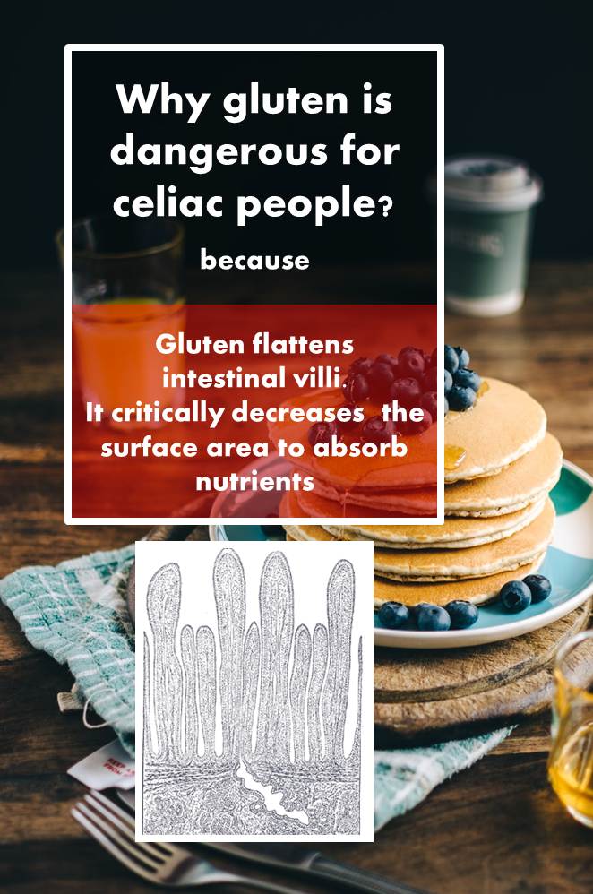 Gluten in foods where you least expect it